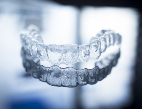 Starting Invisalign Treatment for Adults in Newport Beach CA
